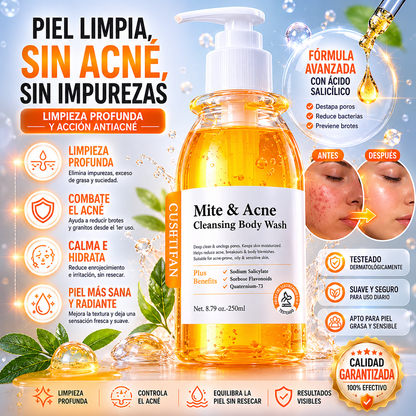 Gel Limpiador Antiacné - Elimina Ácaros, Purifica y Renueva tu Piel
