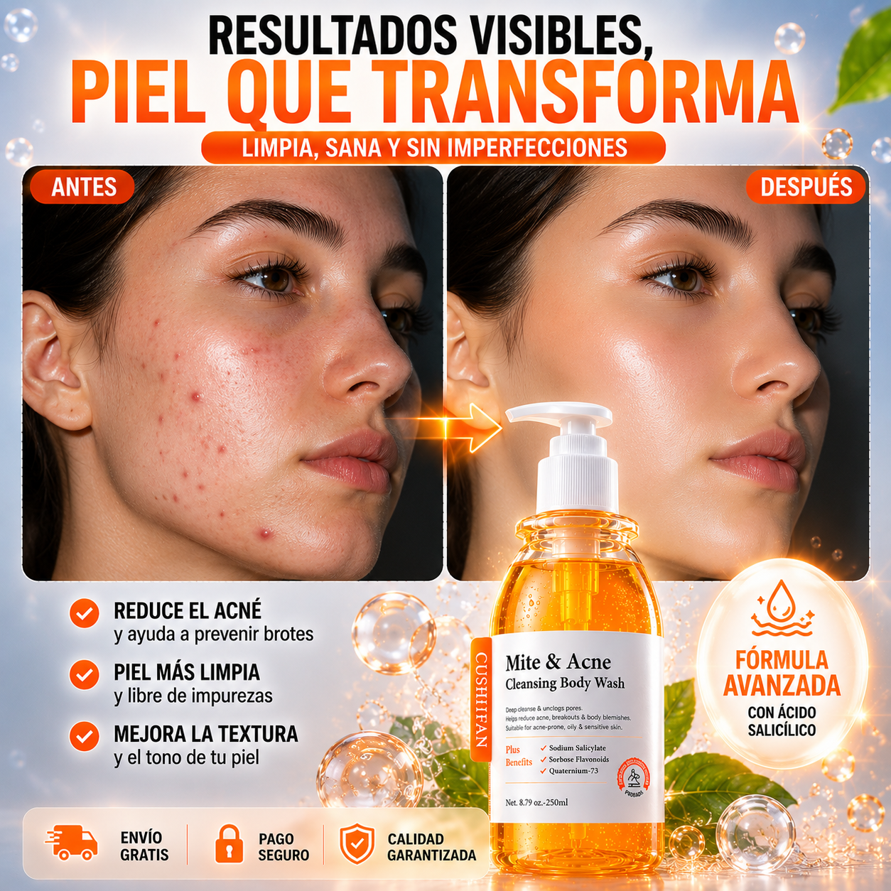 Gel Limpiador Antiacné - Elimina Ácaros, Purifica y Renueva tu Piel